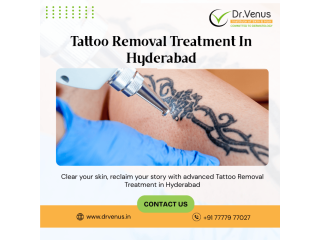 tattoo-removal-treatment-in-hyderabad-dr-venus-small-0