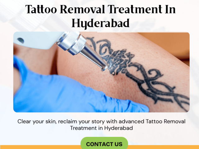 tattoo-removal-treatment-in-hyderabad-dr-venus