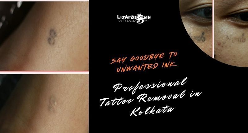 tattoo-removal-in-kolkata-safe-laser-removal-experts-big-0