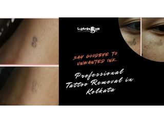 tattoo-removal-in-kolkata-safe-laser-removal-experts-small-0