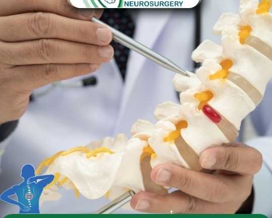 advanced-spine-tumor-surgery-in-ahmedabad-by-dr-chirag-solanki