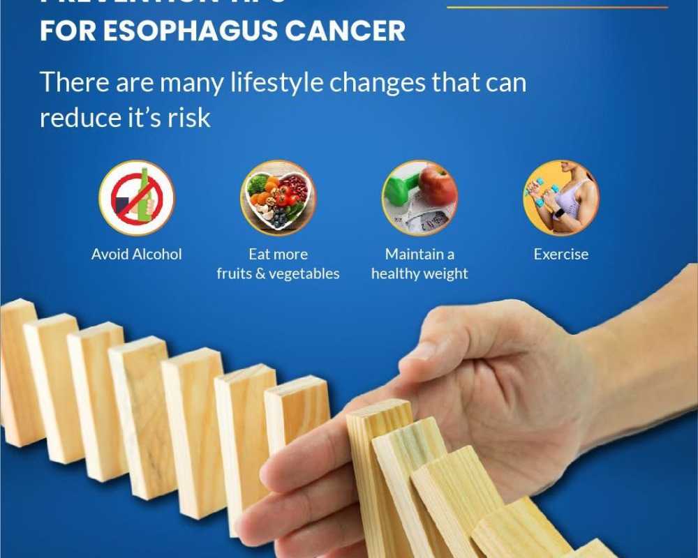 advanced-oncology-care-for-esophageal-cancer-treatment