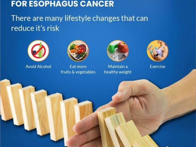 advanced-oncology-care-for-esophageal-cancer-treatment