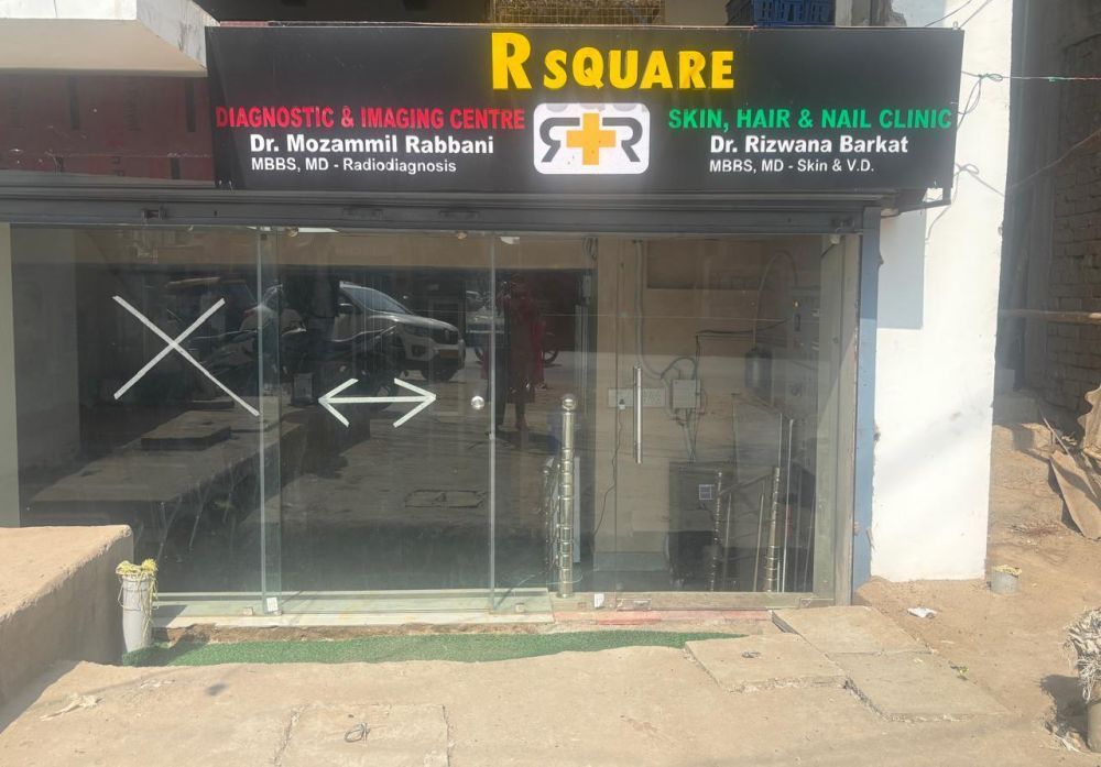 mole-removal-treatment-in-patna-from-dr-rizwana-barkat-big-1
