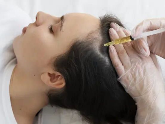 exosome-gfc-hair-treatment-in-coimbatore-for-hair-regrowth