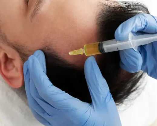 biotin-prp-treatment-in-coimbatore-for-hair-growth