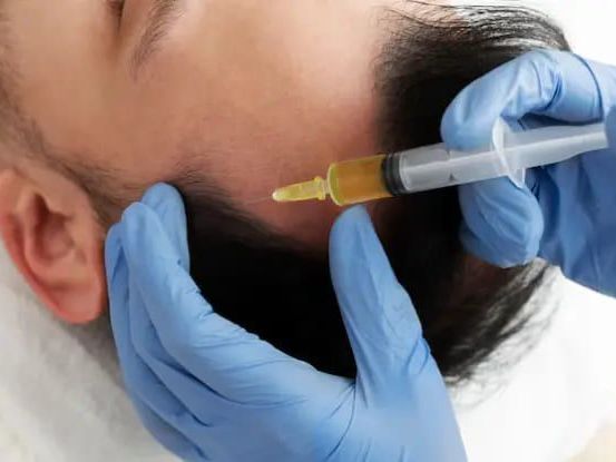 biotin-prp-treatment-in-coimbatore-for-hair-growth