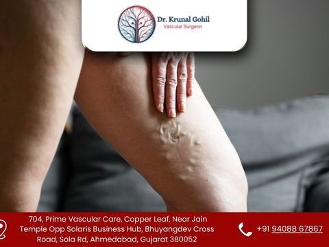 restore-healthy-legs-with-advanced-vein-care