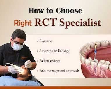 root-canal-treatment-cost-in-hyderabad-fms-dental