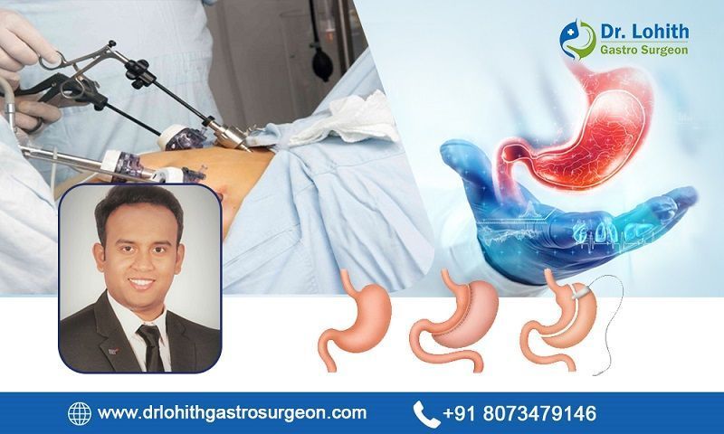 best-surgical-gastroenterology-in-bangalore-big-0