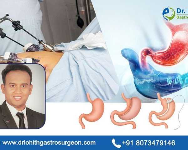 best-surgical-gastroenterology-in-bangalore