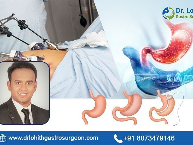 best-surgical-gastroenterology-in-bangalore