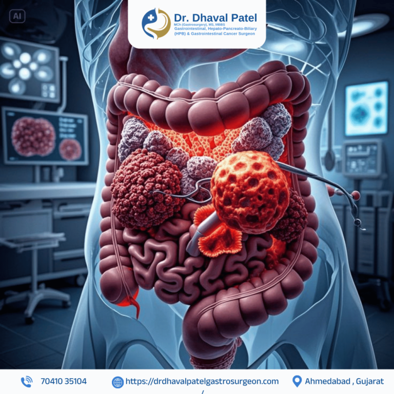 gi-cancer-surgery-with-personalized-care-by-dr-dhaval-patel-big-0