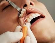 best-dentist-in-chetla-for-advanced-dental-care-big-0