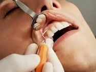 best-dentist-in-chetla-for-advanced-dental-care
