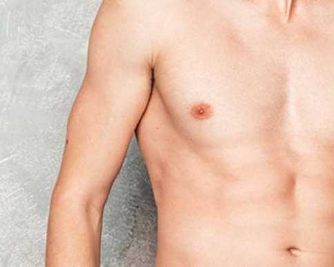 restore-confidence-with-gynecomastia-surgery-in-mumbai