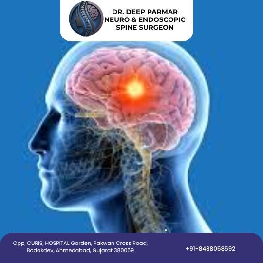brain-tumor-surgery-in-ahmedabad-by-dr-deep-parmar-big-0