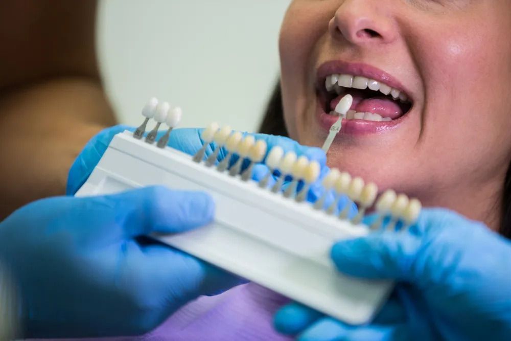 transform-your-smile-with-dental-veneers-plus-dental-clinic-big-0