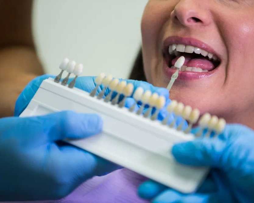 transform-your-smile-with-dental-veneers-plus-dental-clinic