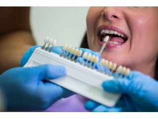transform-your-smile-with-dental-veneers-plus-dental-clinic-small-0