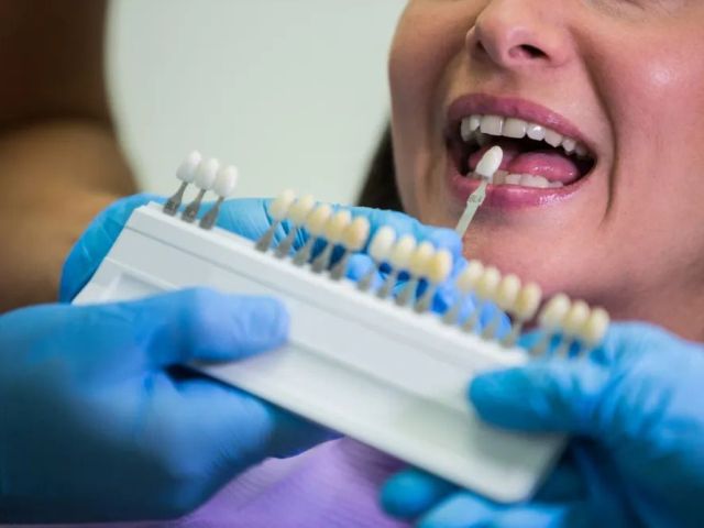 transform-your-smile-with-dental-veneers-plus-dental-clinic
