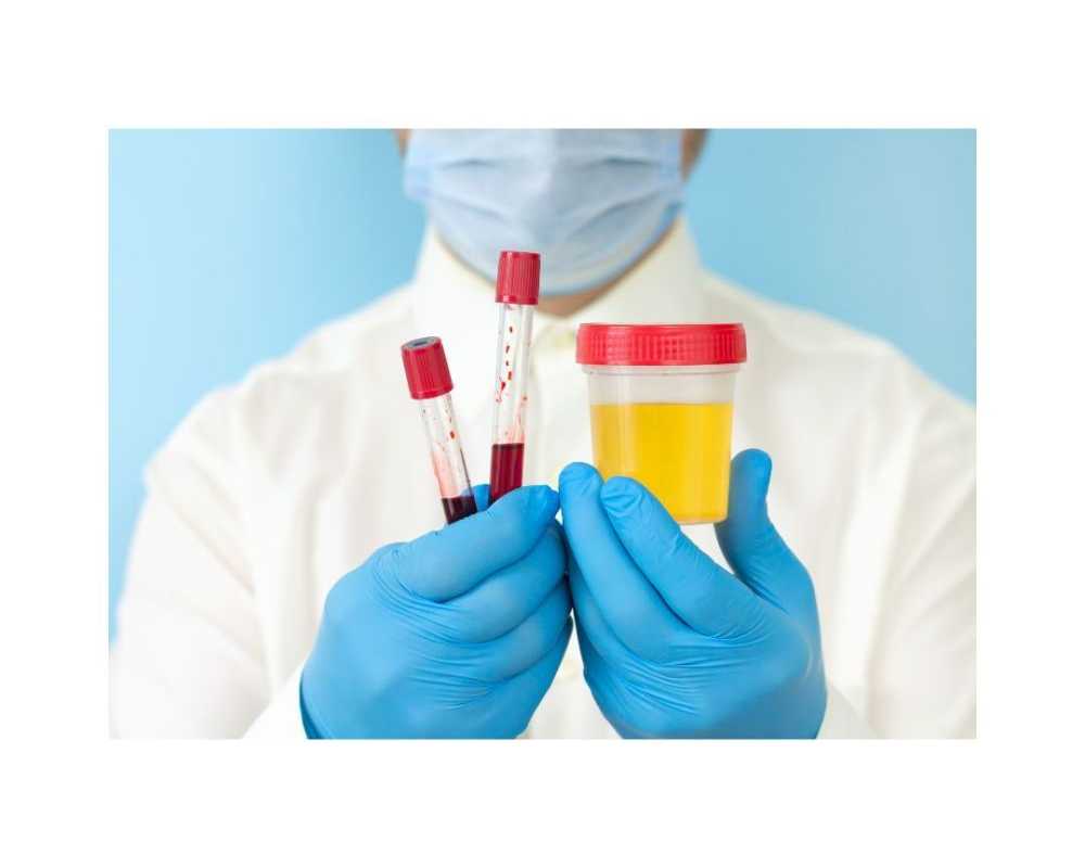 best-doctor-for-urine-infection-in-delhi-dr-kundu
