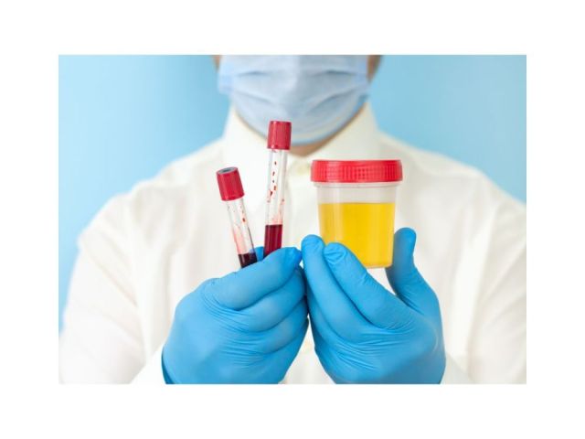 best-doctor-for-urine-infection-in-delhi-dr-kundu
