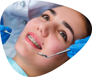 braces-for-teeth-treatment-cost-at-shree-dental-big-0