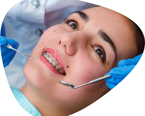 braces-for-teeth-treatment-cost-at-shree-dental