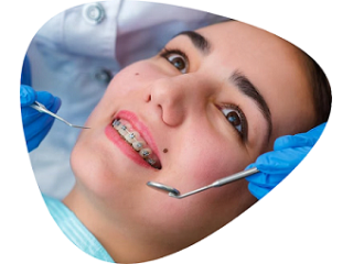 braces-for-teeth-treatment-cost-at-shree-dental-small-0