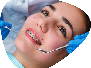 braces-for-teeth-treatment-cost-at-shree-dental