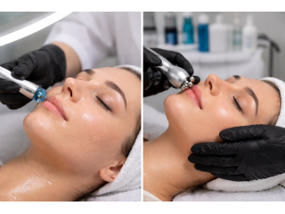 advanced-laser-hair-removal-treatment-in-rohini-small-0