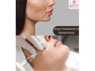 effective-solutions-for-acne-scars-at-kara-skin-clinic-small-0