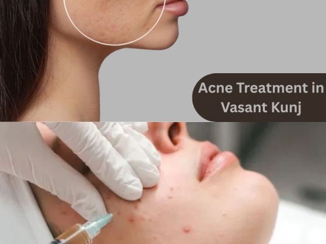 effective-solutions-for-acne-scars-at-kara-skin-clinic