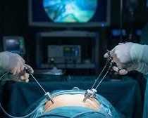 best-hospital-for-laparoscopic-surgery-in-kolkata