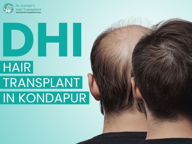 trusted-dhi-hair-transplant-clinic-in-kondapur