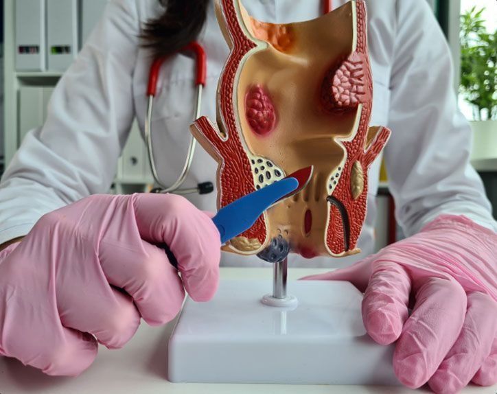 advanced-care-for-fistula-and-fissure-problems-in-delhi-big-0