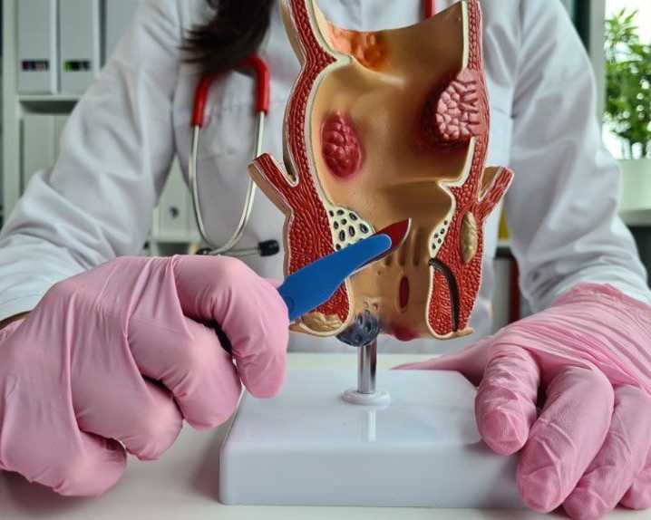 advanced-care-for-fistula-and-fissure-problems-in-delhi