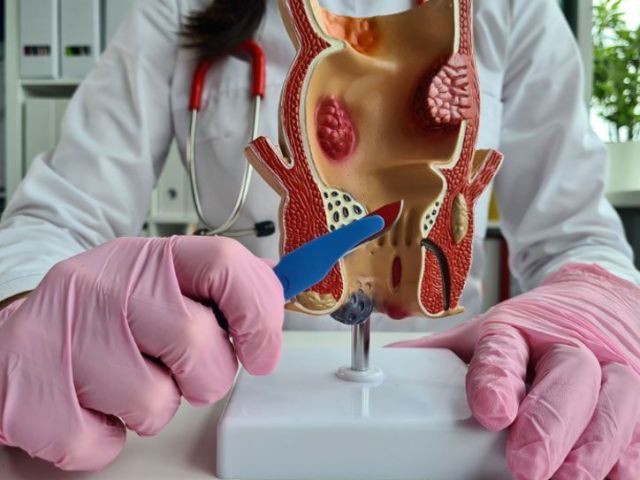 advanced-care-for-fistula-and-fissure-problems-in-delhi