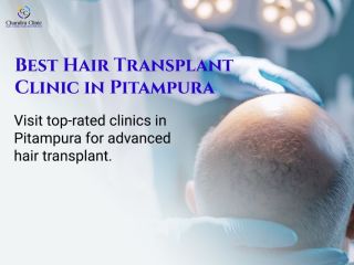 advanced-hair-transplant-surgery-in-delhi-for-natural-hair-growth-small-0