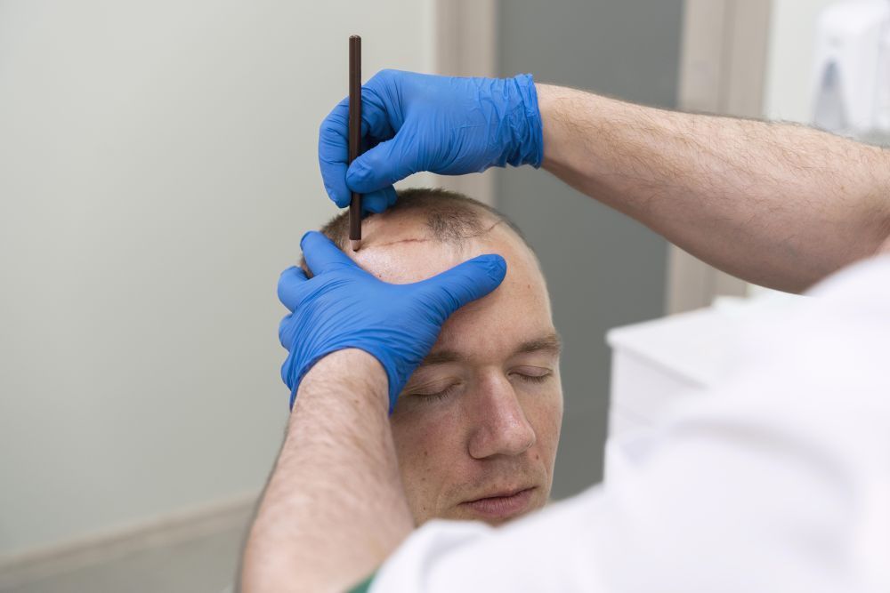 best-hair-transplant-clinic-in-pune-arnica-clinic-big-1