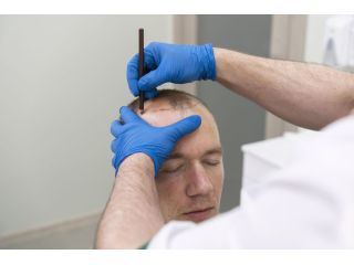 best-hair-transplant-clinic-in-pune-arnica-clinic-small-1