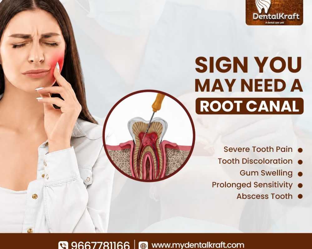 rct-clinic-in-indirapuram-offering-painless-root-canal-treatment
