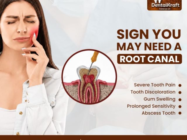 rct-clinic-in-indirapuram-offering-painless-root-canal-treatment