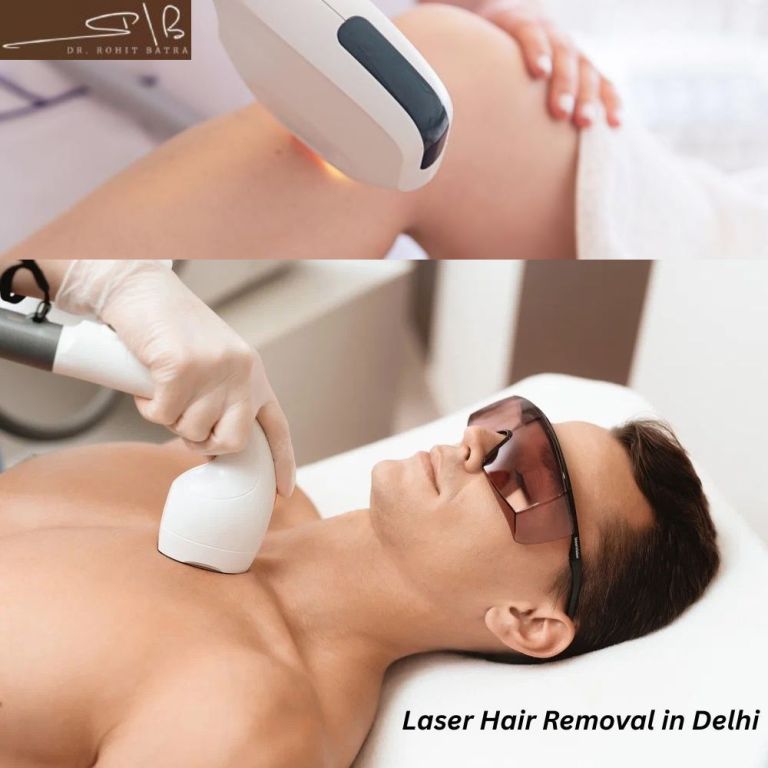 advanced-laser-hair-removal-treatments-by-dr-rohit-batra-big-0