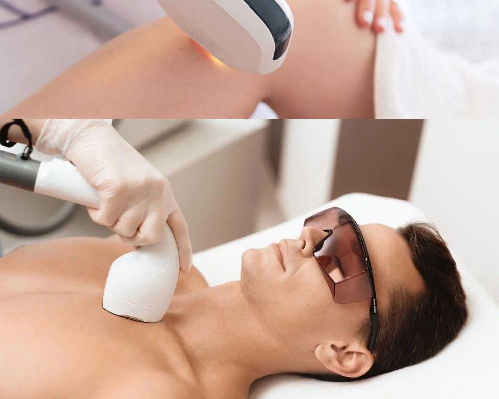advanced-laser-hair-removal-treatments-by-dr-rohit-batra
