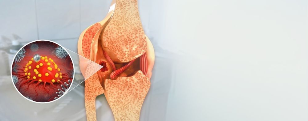 bone-cancer-hospital-in-delhi-big-0