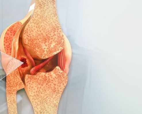 bone-cancer-hospital-in-delhi