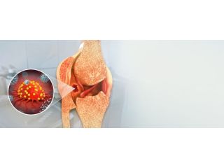 bone-cancer-hospital-in-delhi-small-0