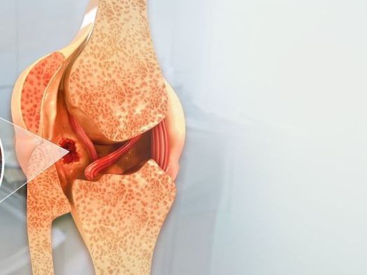 bone-cancer-hospital-in-delhi
